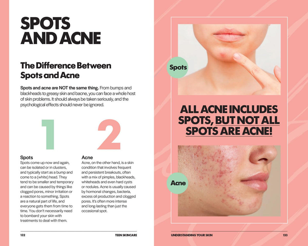 Teen Skincare: The Ultimate No Nonsense Guide
